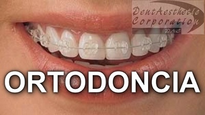 DentAesthetic corporation en Sabadell, resuelve tus dudas sobre Ortodoncia