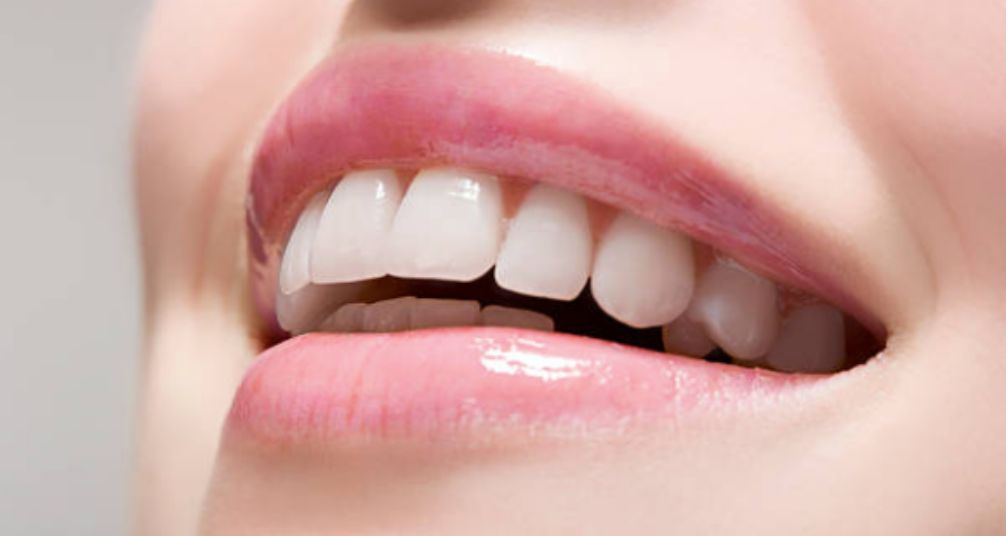 ¿Cuánto duran los implantes dentales?