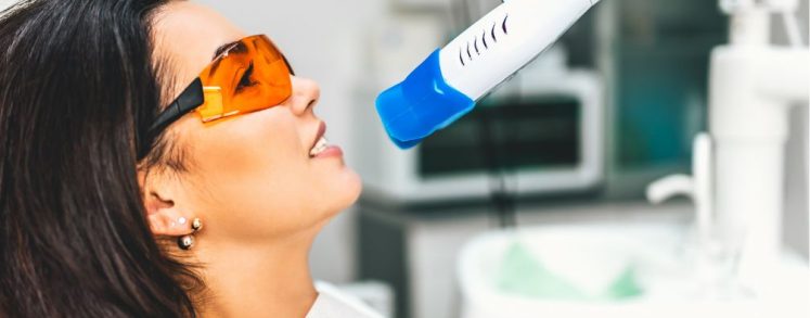 Descubre el blanqueamiento dental en Sabadell con tecnología LED avanzada