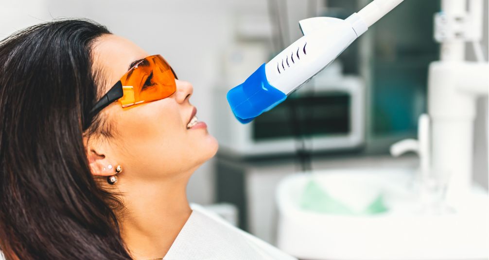 blanqueamiento dental en Sabadell